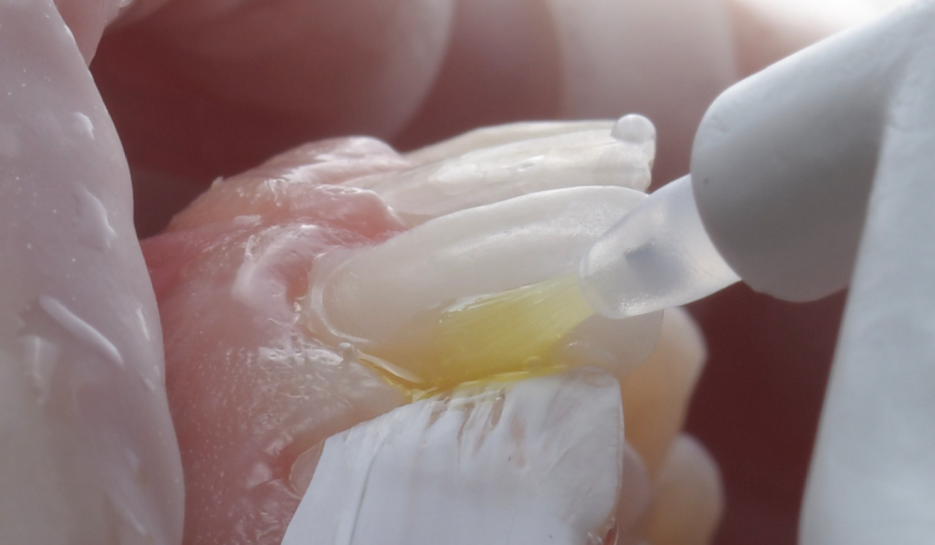 Figure 8: Application of the universal adhesive.